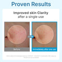 Madeca Lab Hyal Waterfull Glow Gel Mask 5ea